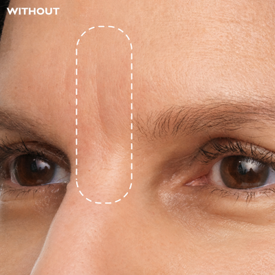Peptide Face Tape