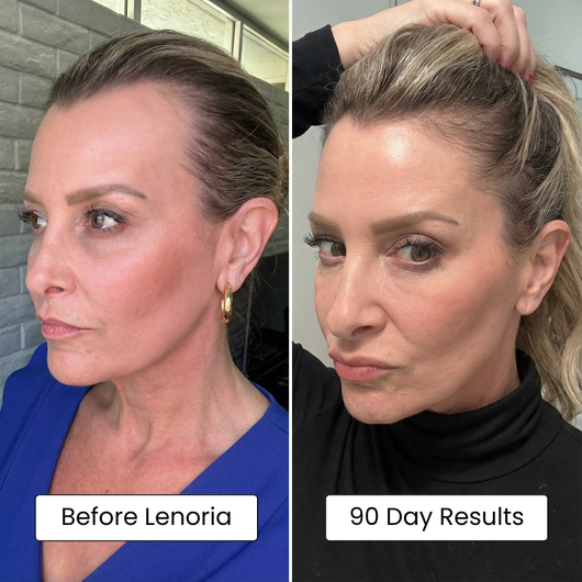 Lenoria Pumpkin Seed Oil Capsules