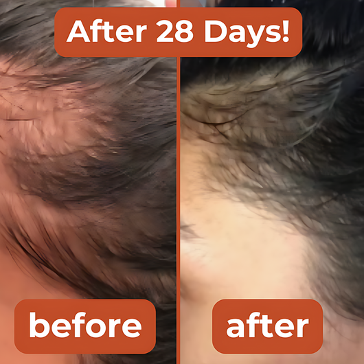 Hair Regrowth Kit