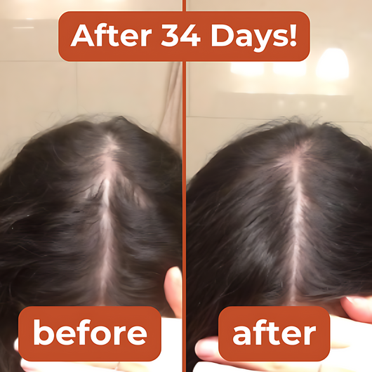 Hair Regrowth Kit