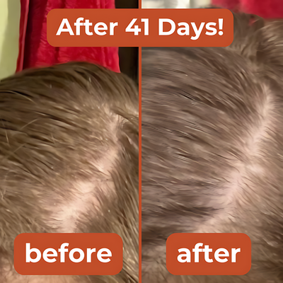 Hair Regrowth Kit
