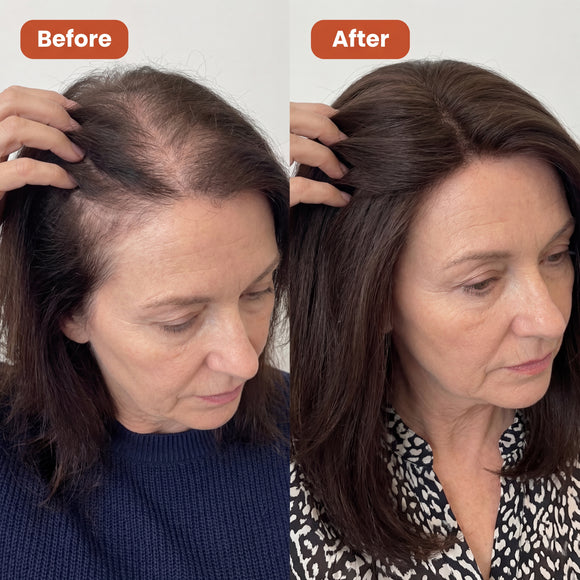 Feature product image